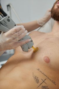 Подготовка к лазерной эпиляции: что нужно знать