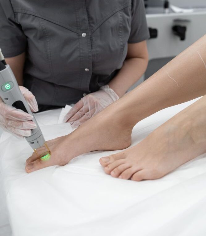 Эпиляция пальцев ног